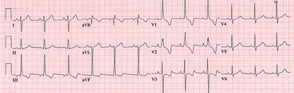 Test Yourself MKSAP image  2010 American College of Physicians Medical Knowledge Self-Assessment Program MKSAPless-thansupgreater-thanless-thanslashsupgreater-than 15