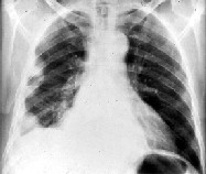 MKSAP image copyright American College of Physicians Medical Knowledge Self-Assessment Program