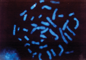 Photomicrograph of less-thanigreater-thanBRCA2less-thanslashigreater-than gene on chromosome 13 red and green probes Photo copyright Dorothy Warburton PhDslashPhototake