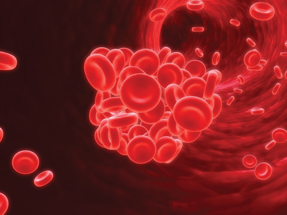 New oral anticoagulants dont require checking a patients INR levels But theyre more expensive physicians cant check efficacy and compliance and theres no antidote in case of bleeding Photo by