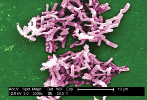 This micrograph depicts gram-positive less-thanigreater-thanC difficileless-thanslashigreater-than bacteria from a stool sample culture obtained using a 01-microm filter Photo from CDCslashJanice Carr