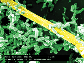 Image of a Pseudomonas and Aspergillus biofilm, courtesy of Jose A Vazquez, MD, FACP