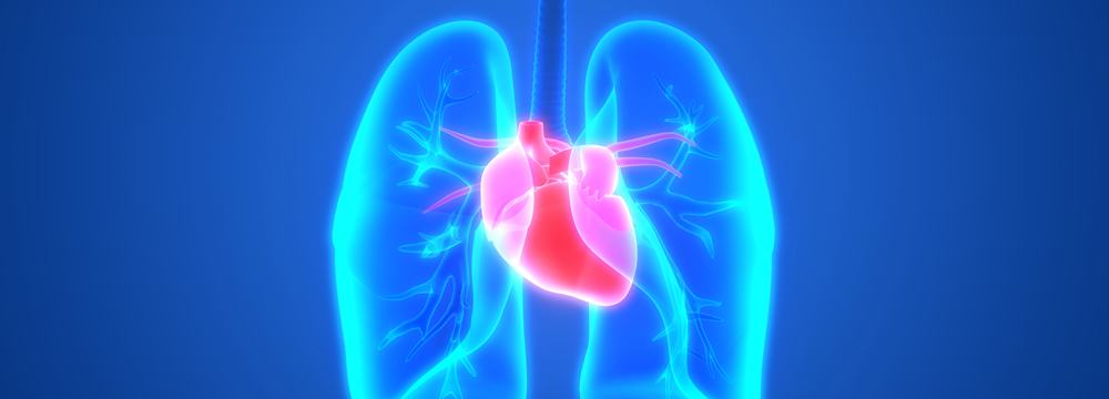 Patients being screened for lung cancer should be alerted that there is a high likelihood a nodule requiring monitoring will be identified and that they should be willing to return annually even if th