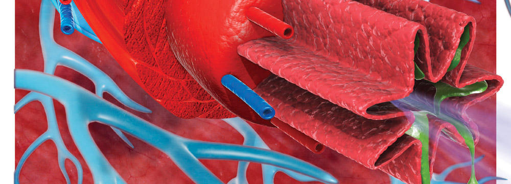 A digital cross-section illustrates the trachea and bronchioles in the lung of a patient with asthma Image by Dorling Kindersley RF