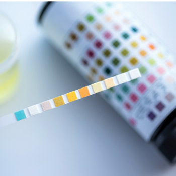 Because chronic kidney disease does not become symptomatic until a significant amount of kidney function is lost screening patients with diabetes with urine albumin testing is key to diagnosis and pr