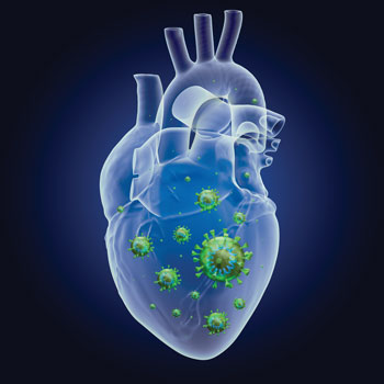 According to established case definitions the classic presentation for COVID-19 vaccine-associated myocarditis is chest pain one to seven days after vaccination with a median time of three days afte