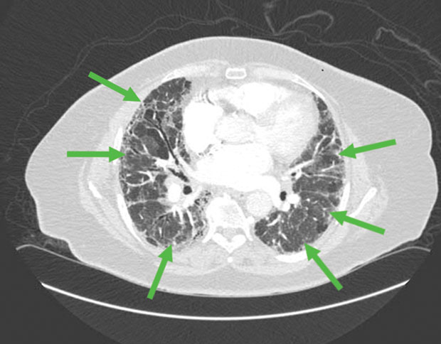 MKSAP image  American College of Physicians